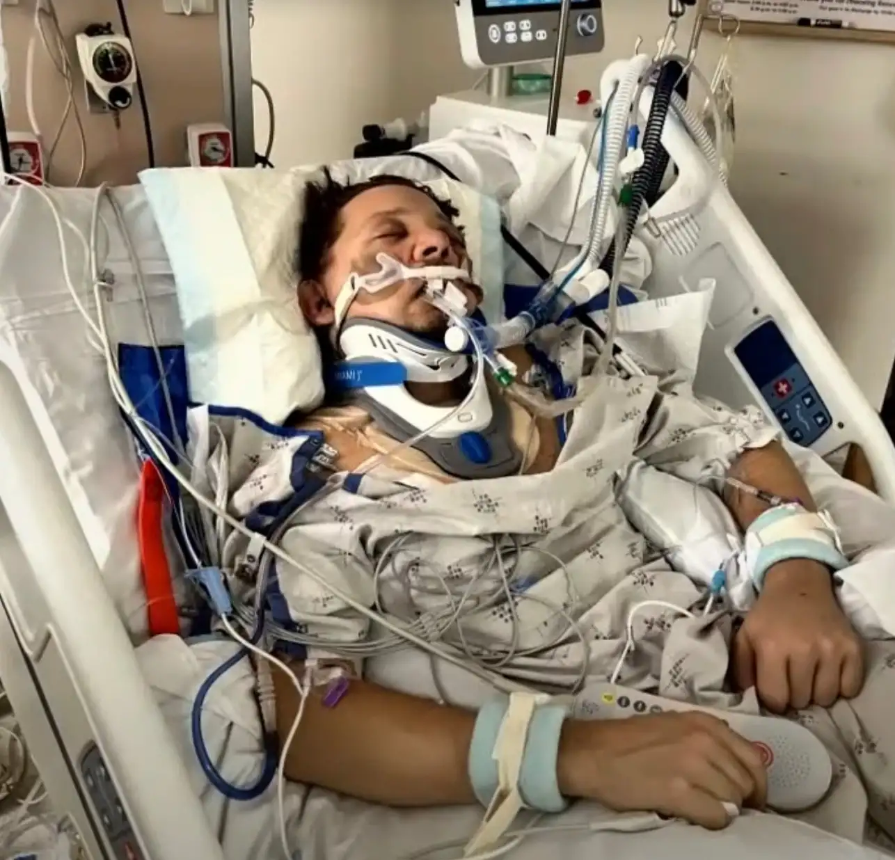 Jeremy Renner suffered 