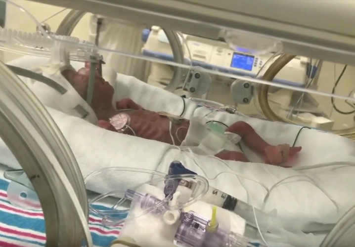 Hannah was born when she was just 25 weeks old (Source: YouTube)