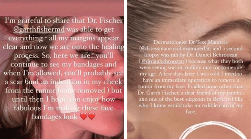 (KHLOE KARDASHIAN/INSTAGRAM)