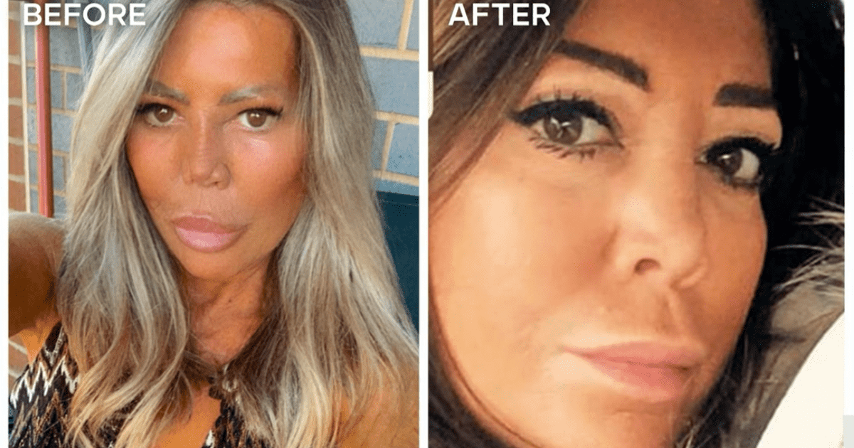 'Botched' Season 8 patient, Demi Moore after her first rhinoplasty went wrong (E!Entertainment)