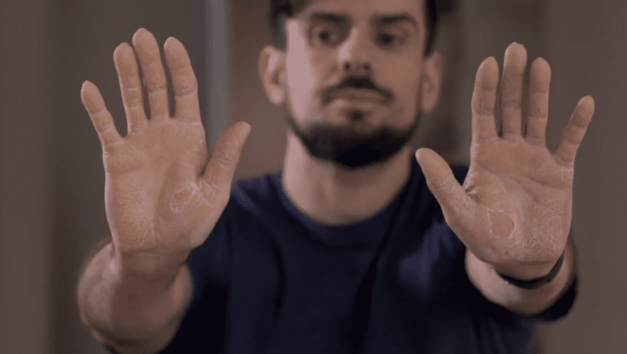 Felipe on 'Dr Pimple Popper' Season 9 episode 14 (TLC)