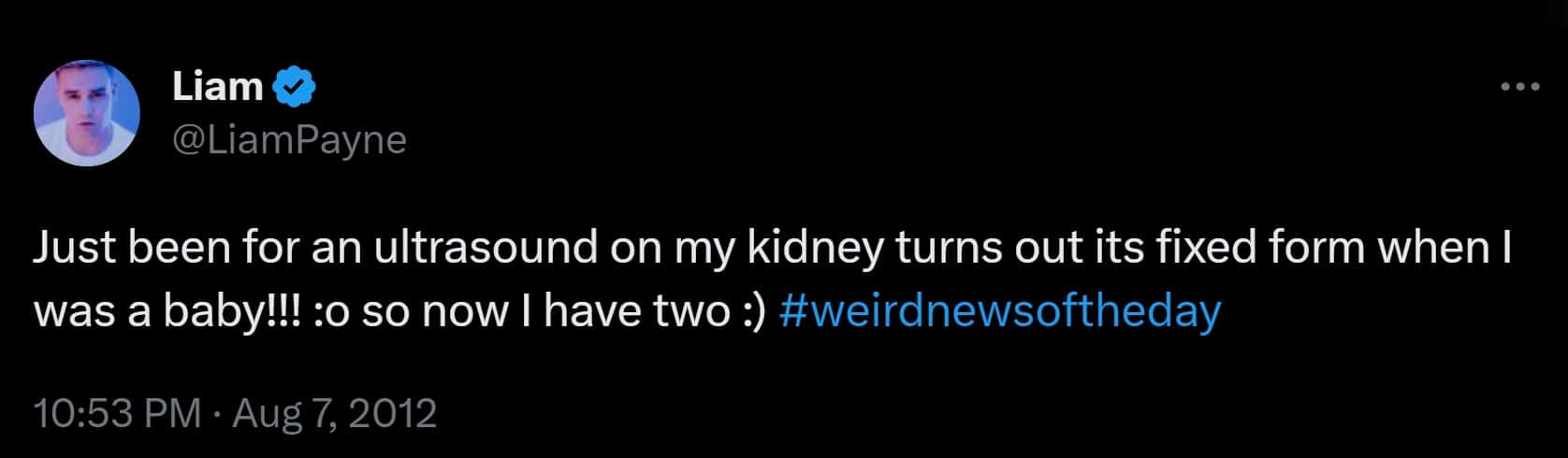 Liam Payne revealed in 2012 that his second kidney got 'fixed' itself (Twitter/@LiamPayne)
