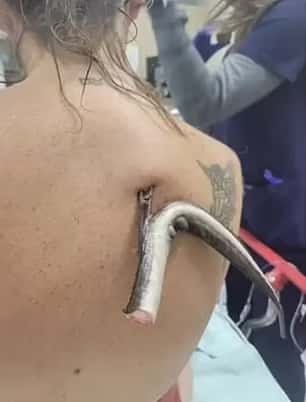 Kristie O'Brien had a brush with death reminiscent to famed Australian Crocodile Hunter Steve Irwin after a stingray impaled her back on a Tampa beach - missing her lungs by just four inches 

