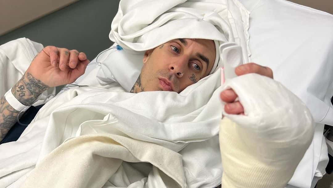 Blink182 drummer Travis Braker got fixed torn ligament of the finger surgically (Instagram/@travisbarker)