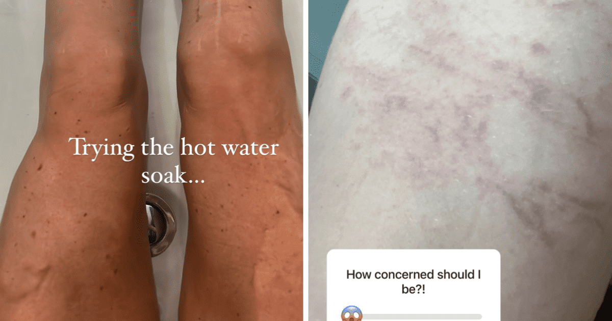 (Instagram@lindseyvonn)