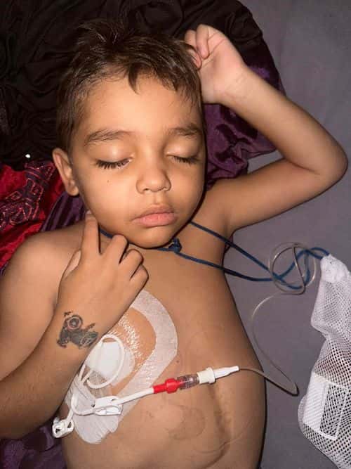 Mateoh Eggleton, from the Gold Coast, was diagnosed with the chronic granulomatous disease in 2019, which made his white blood cells unable to defend against certain types of bacteria. (Shalyn Eggleton/Facebook)