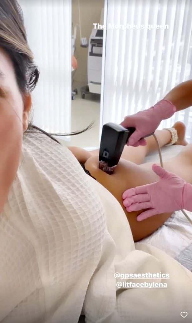 Mia Khalifa treats fans with live butt-lift treatment (Photo from Mia Khalifa's Instagram)