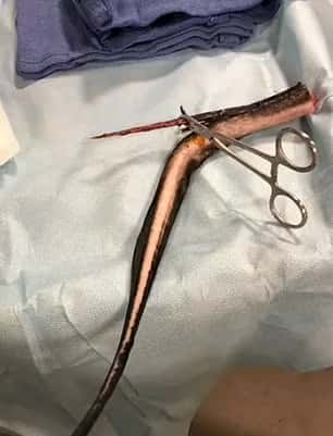 Kristie O'Brien was visiting Ruskin's Bahia Beach with her husband Thomas when she was impaled by a stingray 