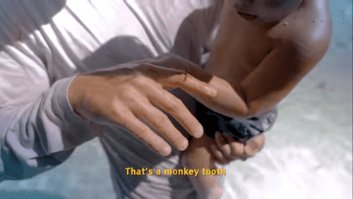 Monkey bitten on Whitlem's finger