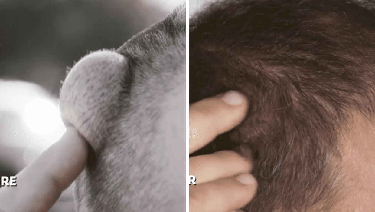 Before and After Madison's surgery in 'Dr Pimple Popper' Season 8 (TLC)