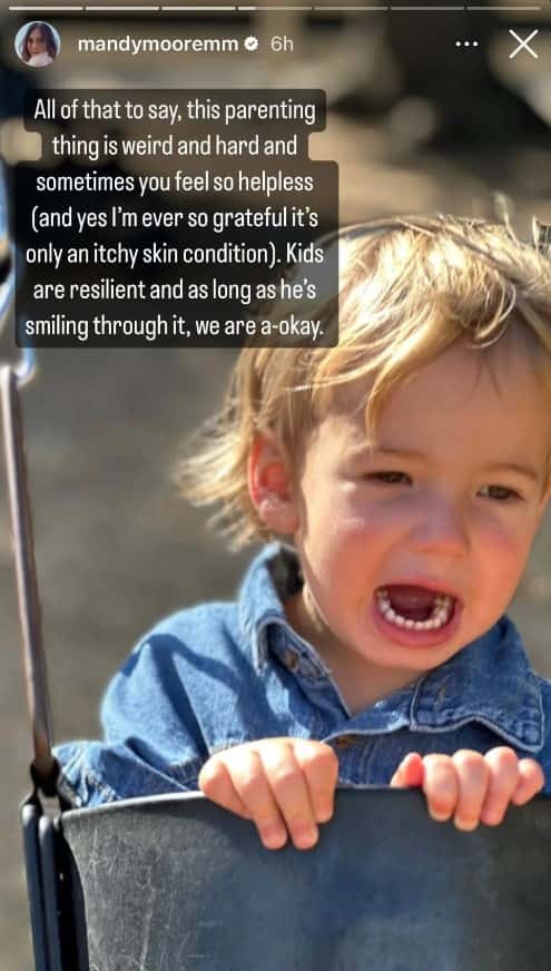Mandy Moore noted that the youngster was still his usual joyful self&nbsp;despite the uncomfortable rash (@mandymooremm/Instagram Story)