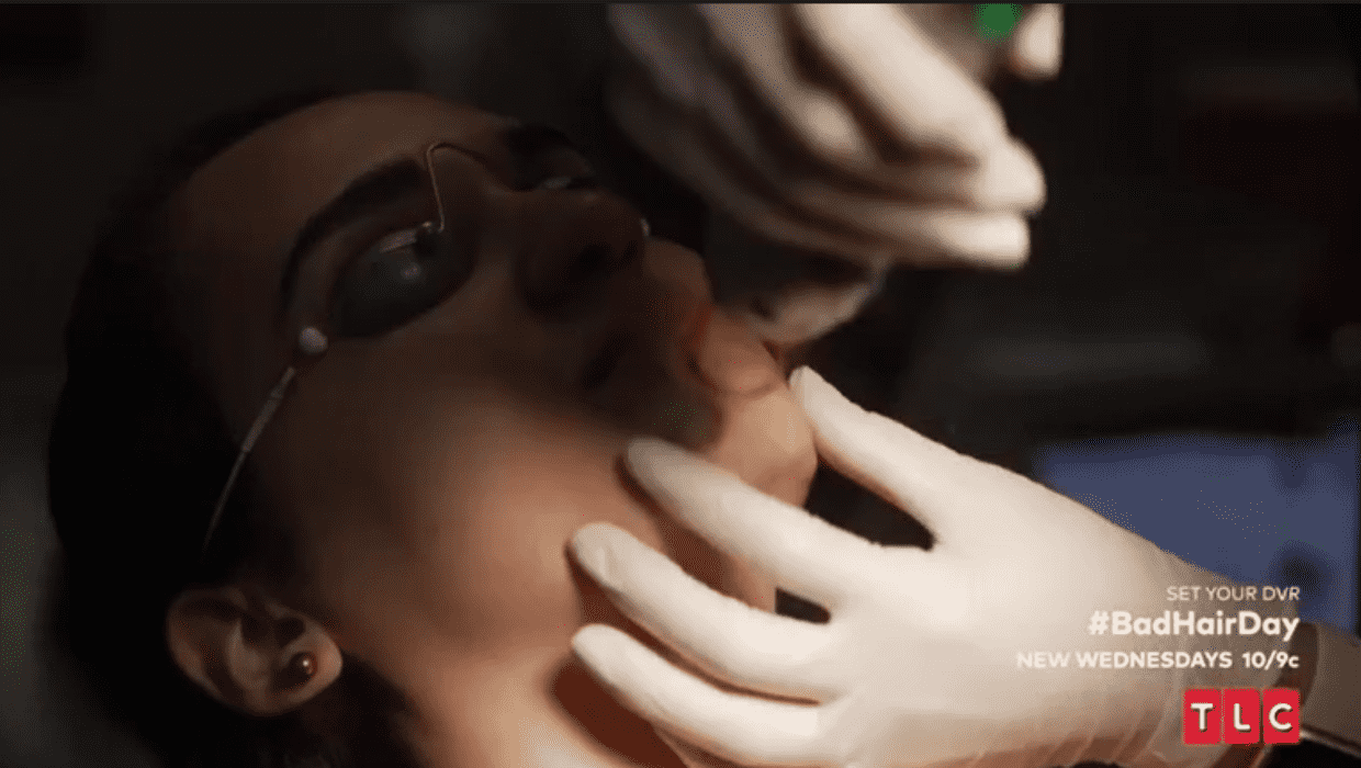 Dr Lopez performing laser hair removal on Charli in 'Bad Hair Day' (TLC