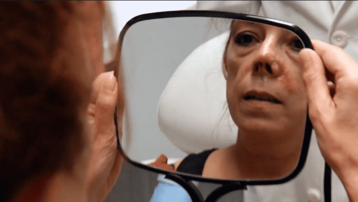 Carolina after her procedure on 'Botched' Season 8 episode 2 (eonline)