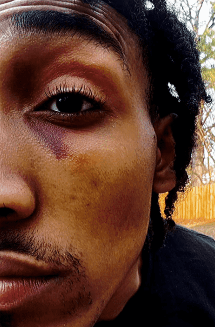 Monterrious Harris has accused members of the Scorpion Unit of beating him up (Photo from lawsuit submitted to the federal court)