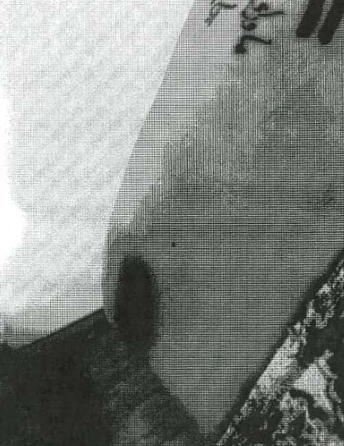 The bruises of Angelina Jolie caused allegedly due to Brad Pitt's attack (FBI)