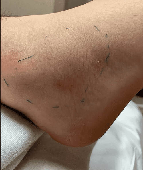 Emilie Ikeda/Instagram