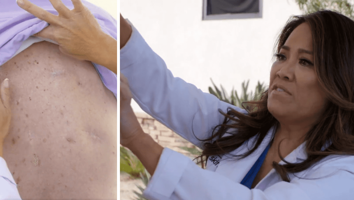 Dr Sandra Lee notices 'anicent blackheads' on Ralph's back in 'Dr Pimple Popper' (twitter/tlc)