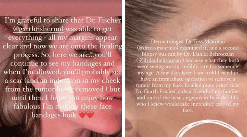 
Khloe Kardashian opened up about her condition in a series of Instagram stories (khloekardashian/Instagram)
