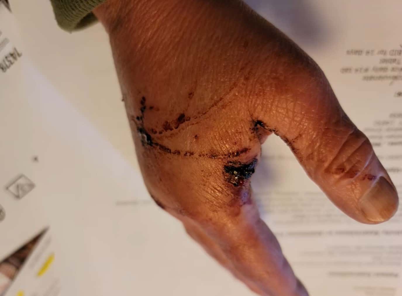 The fox that attacked at least two people in Ithaca was found to have rabies