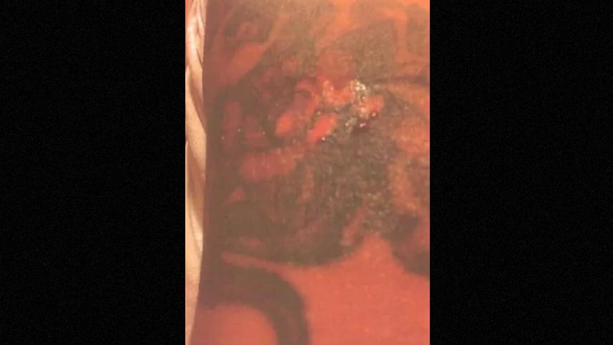 George Lattore's left hand suffered burns and also allegedly permanently damaged his tattoo (Facebook)