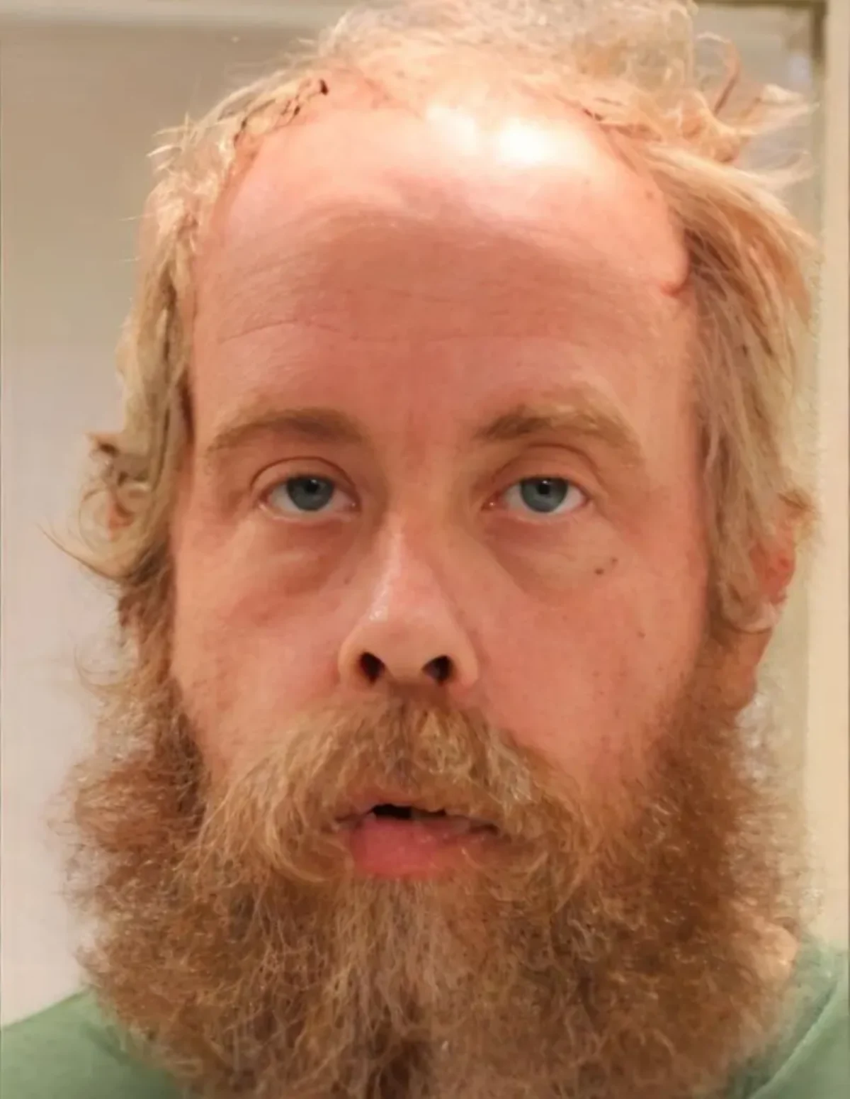 Craig Ross Jr. who suffers from multiple sclerosis, was charged with one count of kidnapping and is expected to face more charges (Saratoga County Jail)