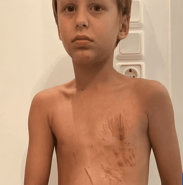 Danny was left shaken and hurt by the horror attack on the tourist hotspot volcano this month