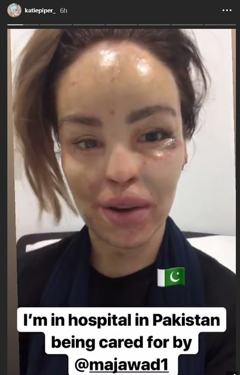 Katie Piper tells fans why she has been missing from social media (Source: katiepiper_, Instagram)