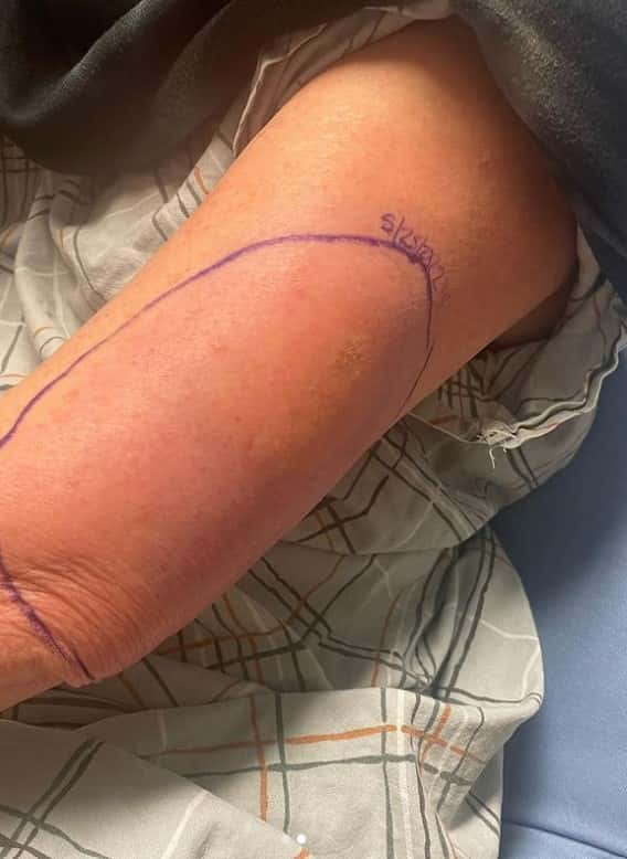 Melissa Gilbert has been to the ER after receiving an insect bite (Instagram/@melissagilbertofficial)

