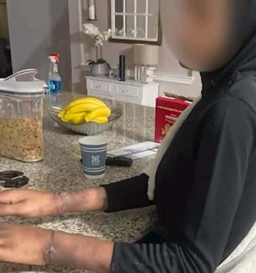 The bruises on the girl's hand (KHOU)
