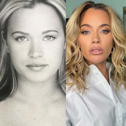 Teddi Mellencamp has been open about her plastic surgery procedures. (Instagram/@teddimellencamp) 