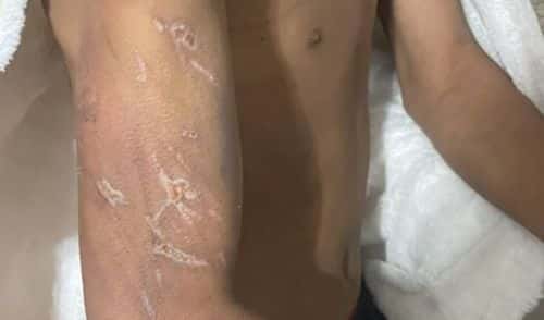 The marks on the boy's hand (KHOU)
