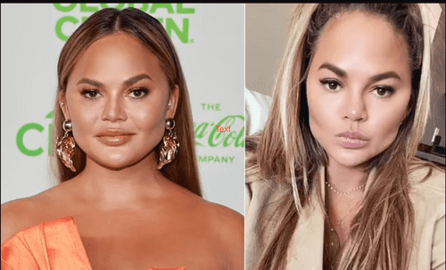 Chrissy Teigen got Buccal Fat Removal last year and shared the news on her Instagram Stories (Getty Images/Instgaram: @chrissyteigen)