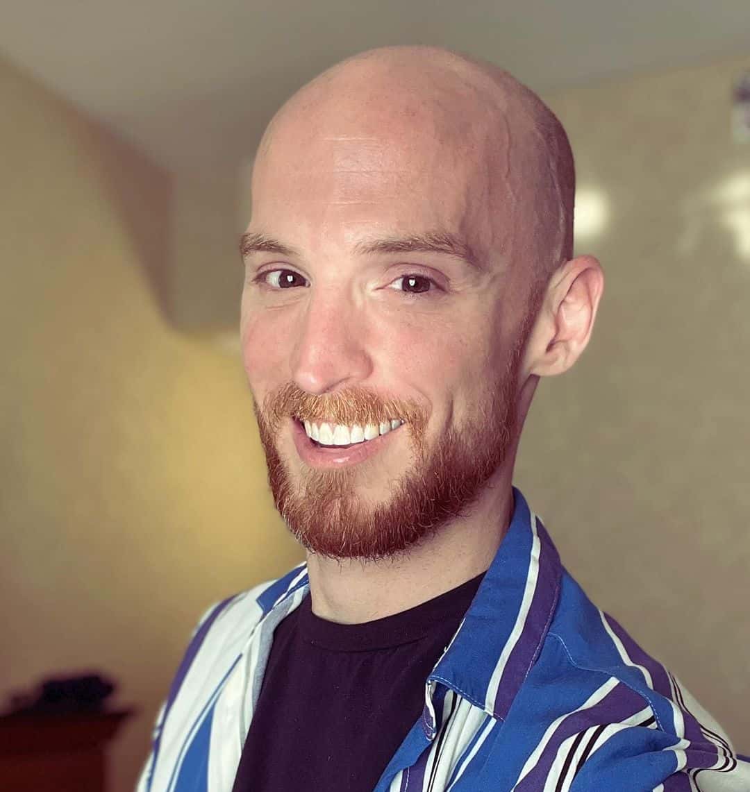 Fish has struggled with substance abuse in the past. (Instagram/@rtalfish) 