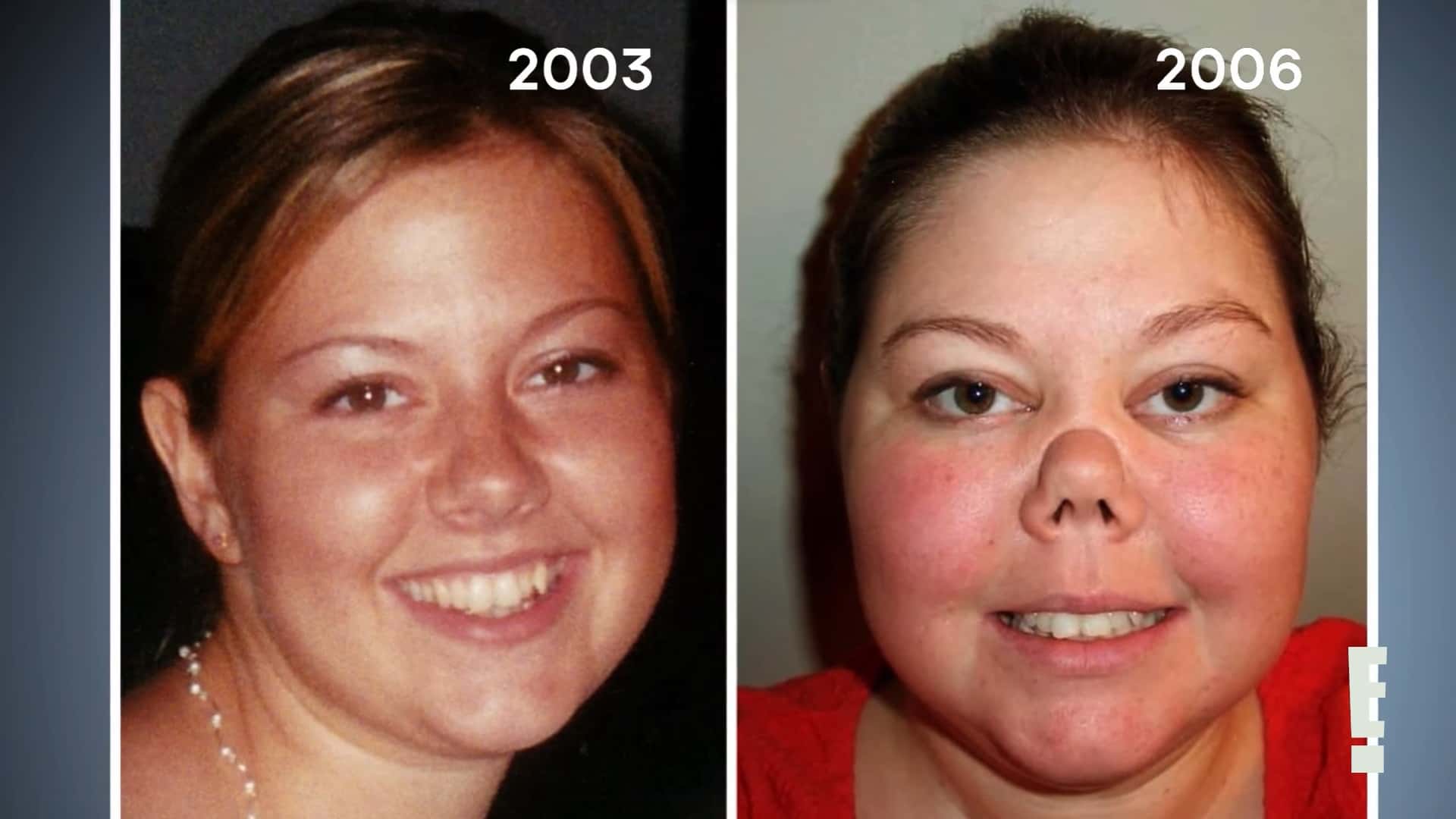 'Botched' Season 8 patient Lori started to get saddle nose deformity in 2006 (Facebook/@eentertainment)