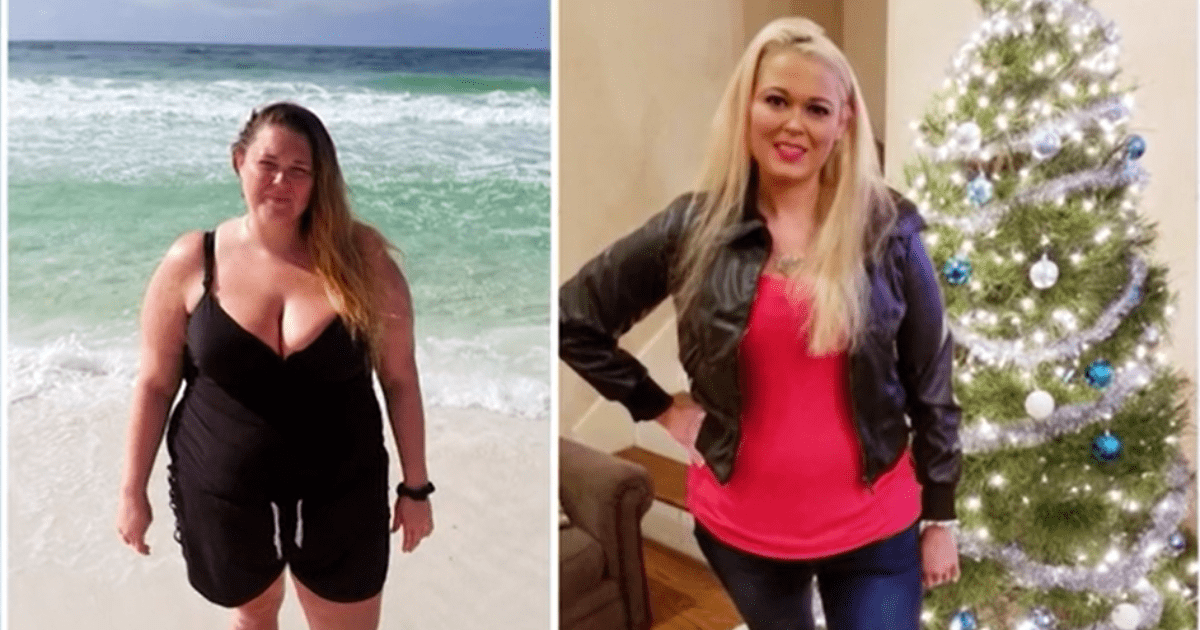 'Botched' patient Mary prior to her mommy makeover (E!Entertainment)