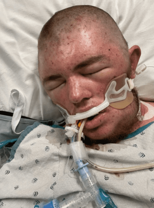 Austin Bellamy was trimming a lemon tree when he cut into a bee's nest (Picture Credit: FOX 19)