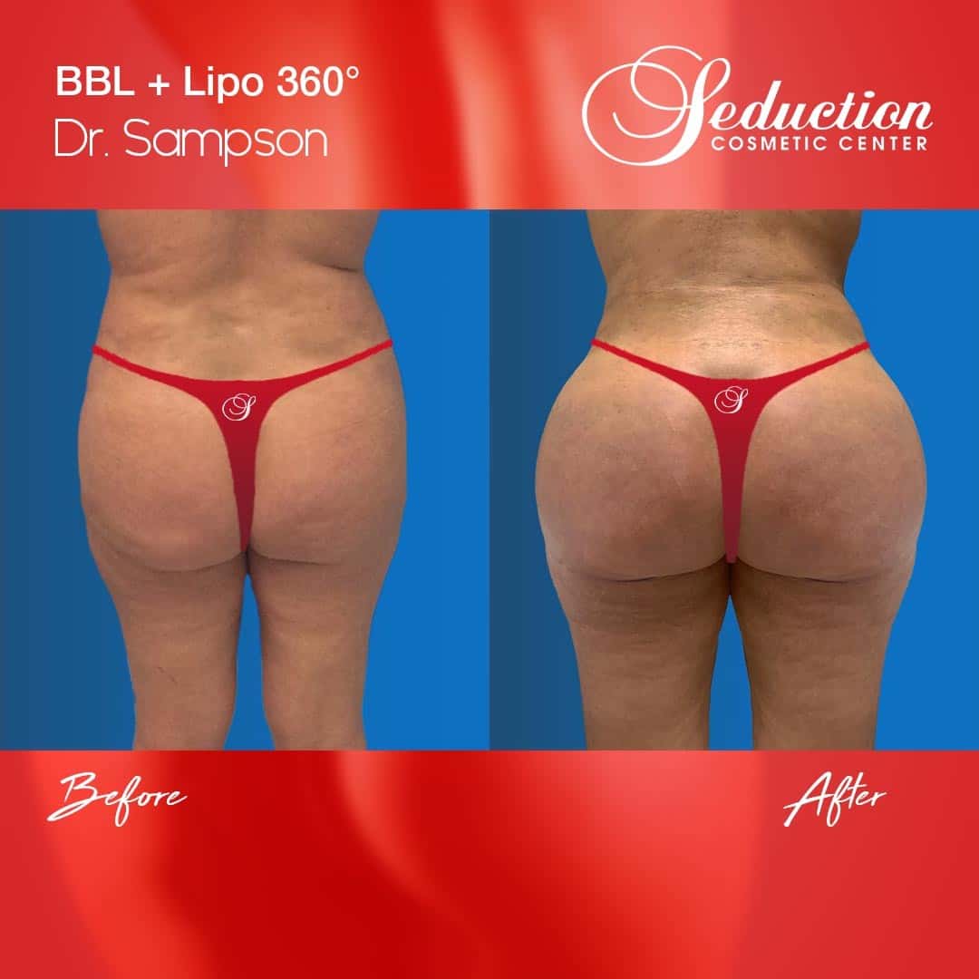 Dr John Sampson provided surgeries for just $3500 ( Seduction Cosmetic Centre/Facebook)