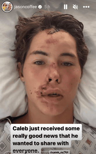 n Instagram Story shared by his father, Jason, revealed that his son is conscious now and his condition has improved (jasoncoffee/Instagram)
