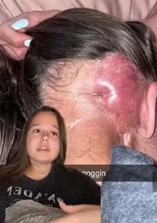 The 17-year-old speaking about her brain tumor (Sammy Ann/ TikTok)