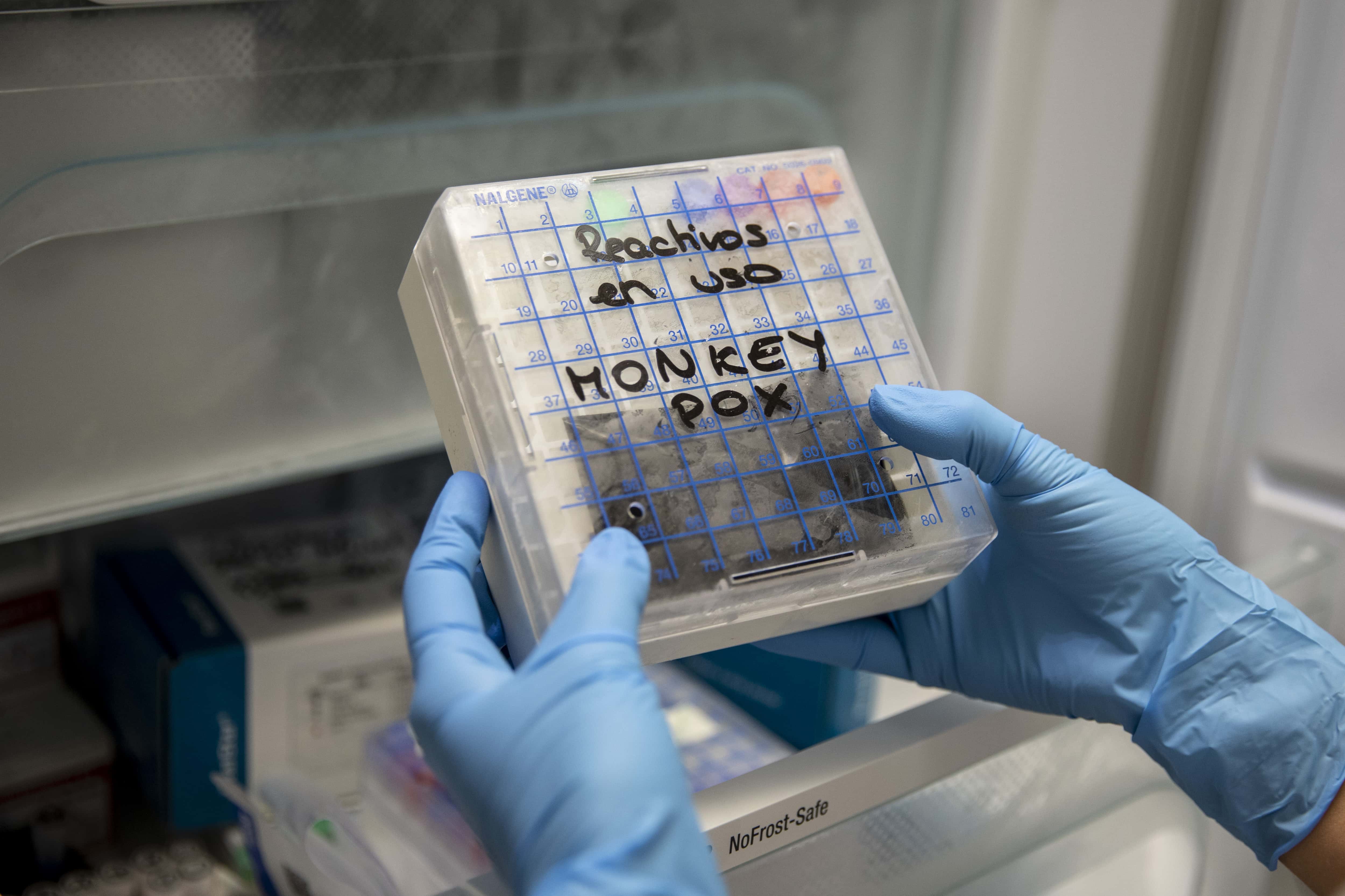 A medical laboratory technician picks up from a fridge a reactive to test suspected monkeypox samples at the microbiology laboratory of La Paz Hospital on June 06, 2022 in Madrid, Spain. Europe is at the centre of the monkeypox virus outbreak, the World Health Organisation reported 780 confirmed cases with Britain, Spain and Portugal reporting the largest numbers of patients.