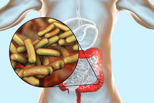 Shigellosis, an infection caused by Shigella bacteria, computer illustration. Shigella sp. are Gram-negative rod-shaped bacteria (bacilli). They infect the large intestine and cause dysentery, which can vary in severity from a mild attack of diarrhoea to an acute infection.