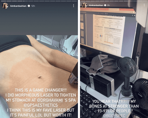 Kim Kardashian took to Instagram on Wednesday to show off her taut tummy while getting a laser procedure to 'tighten' her stomach, which she shared was 'painful' (Kim Kardashian/Instagram)