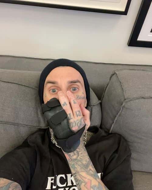 Travis Barker's ring finger gets injured twice ahead of Blink-182 world tour (Instagram/travisbarker)