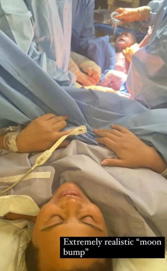 Chrissy Teigen shared an image from her C-section to her Instagram Stories, along with the words, “Extremely realistic ‘moon bump'” (Instagram/@chrissyteigen)