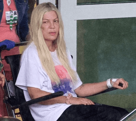 The mom-of-five had a large bruise on her cheek and another on her arm  (*i'macelebrity*/Youtube)