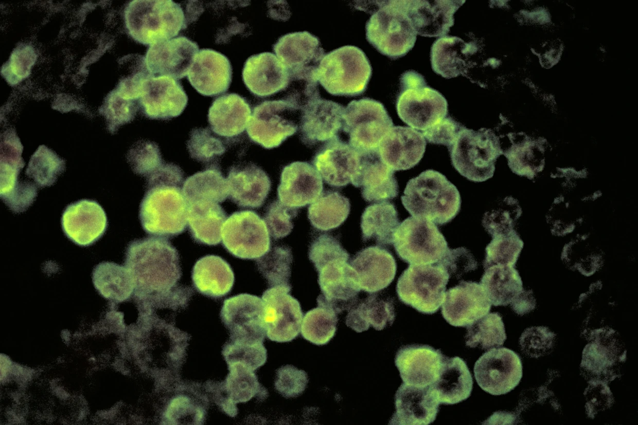 A brain-eating amoeba infected a man in Missouri (DHSS)