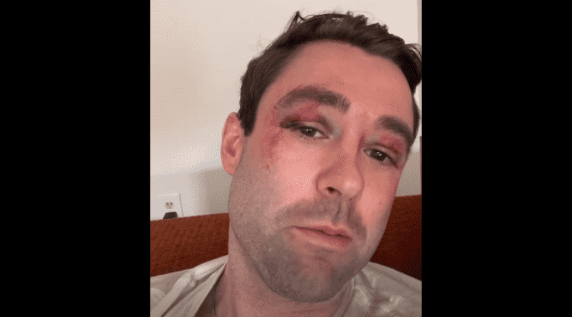 Adam Klotz beaten by teenagers, leaving him with bruised eyes and broken ribs (
adamklotzfnc/ Instagram)