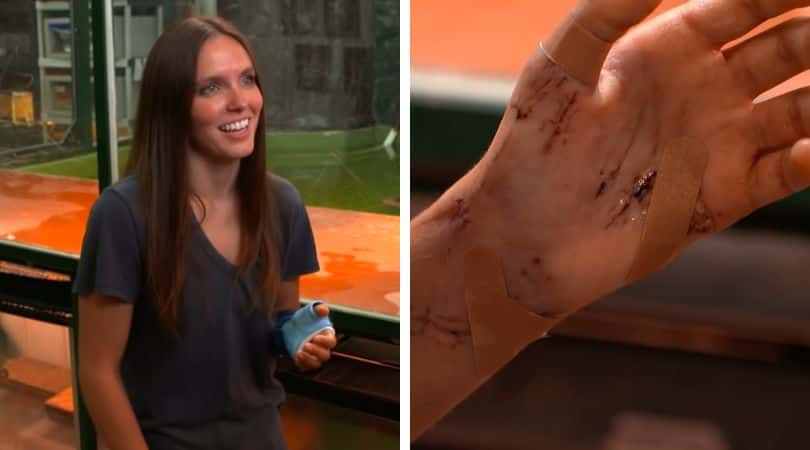 Lyndsey Bull needed surgery and was on antibiotics (Screenshot/YouTube@Inside Edition)