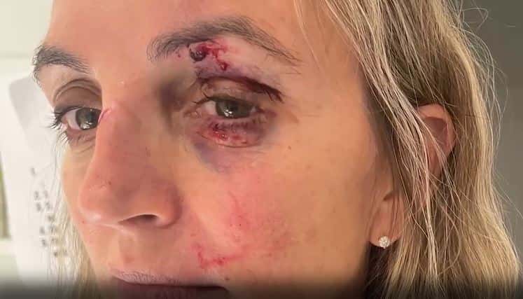 a man viciously thrown the steel bottle at Costantino and she immediately knocked out and falls to the ground