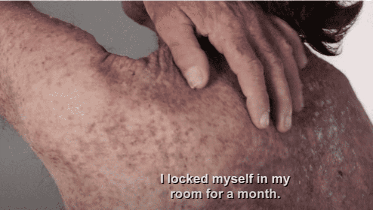 Jimmy meets Dr Lee to put an end to his misery  (YouTube/tlc)